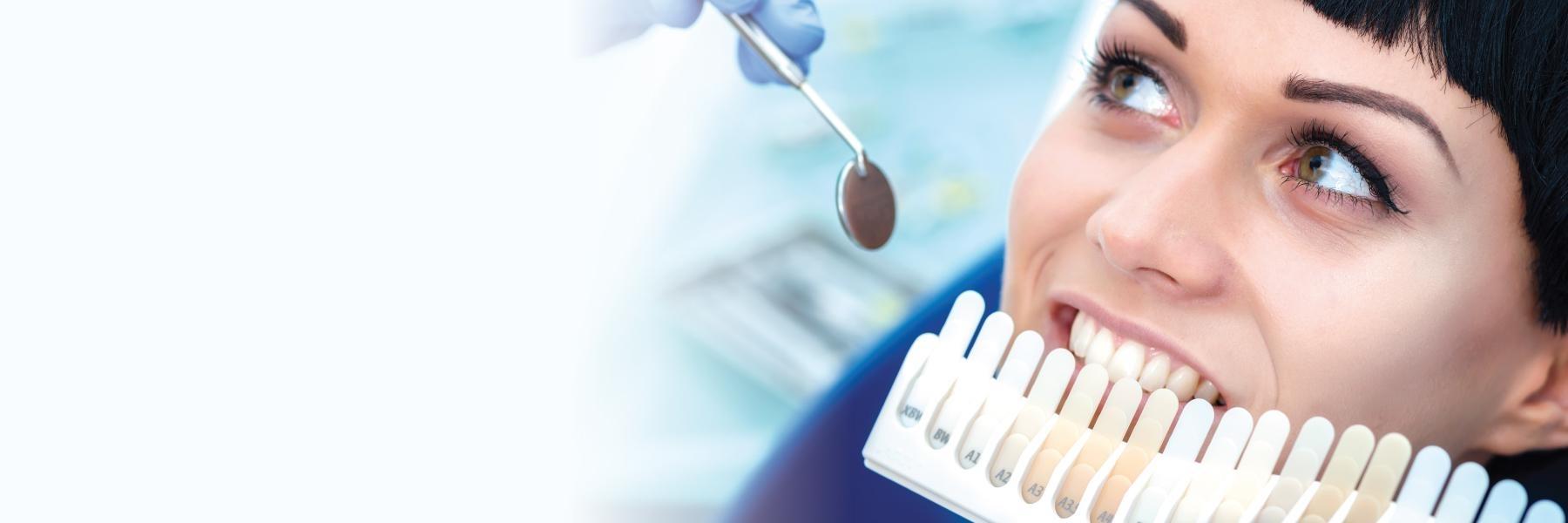 teeth whitening mount pleasant sc