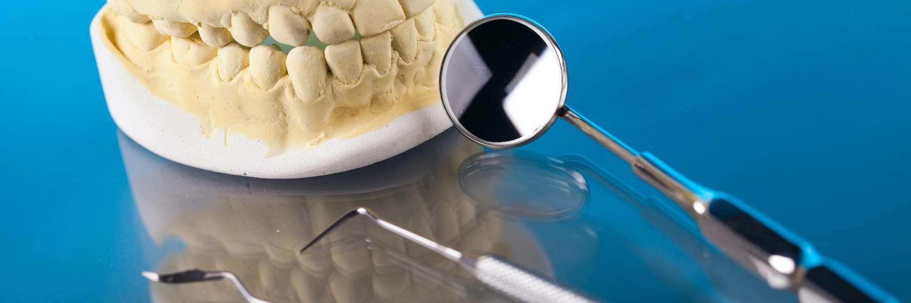 a dental cast, mirror and other dental tools in Mount Pleasant, SC