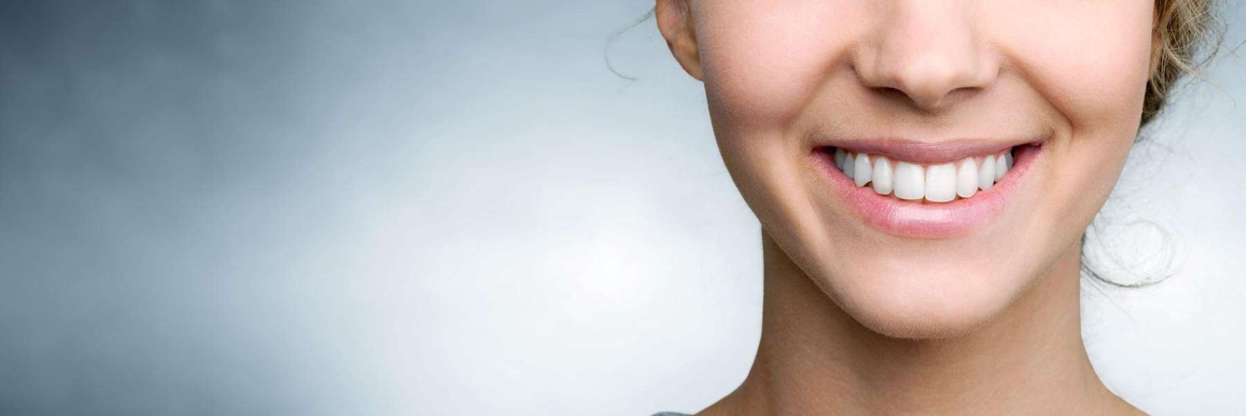 A close up of a lady with dental crowns in Mt. Pleasant, SC