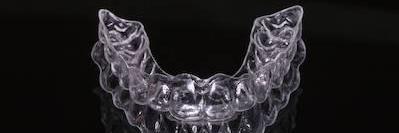 image of clear braces in mount pleasant sc
