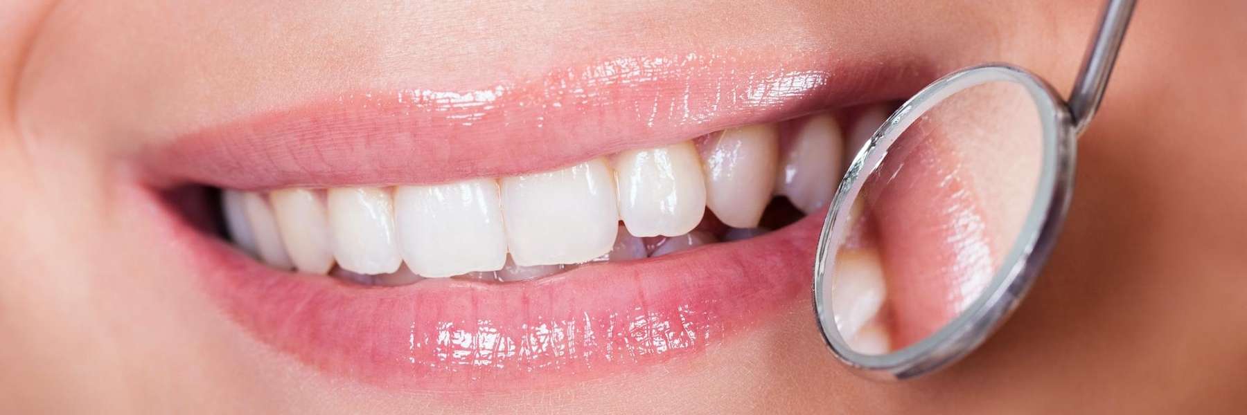 a photo of a woman smiling