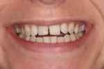 braces in mount pleasant