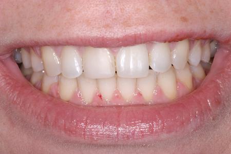 dentist in mount pleasant sc